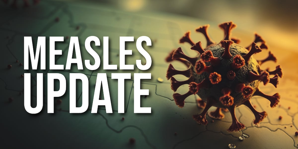 Virginia’s second measles case confirmed in Charlottesville
