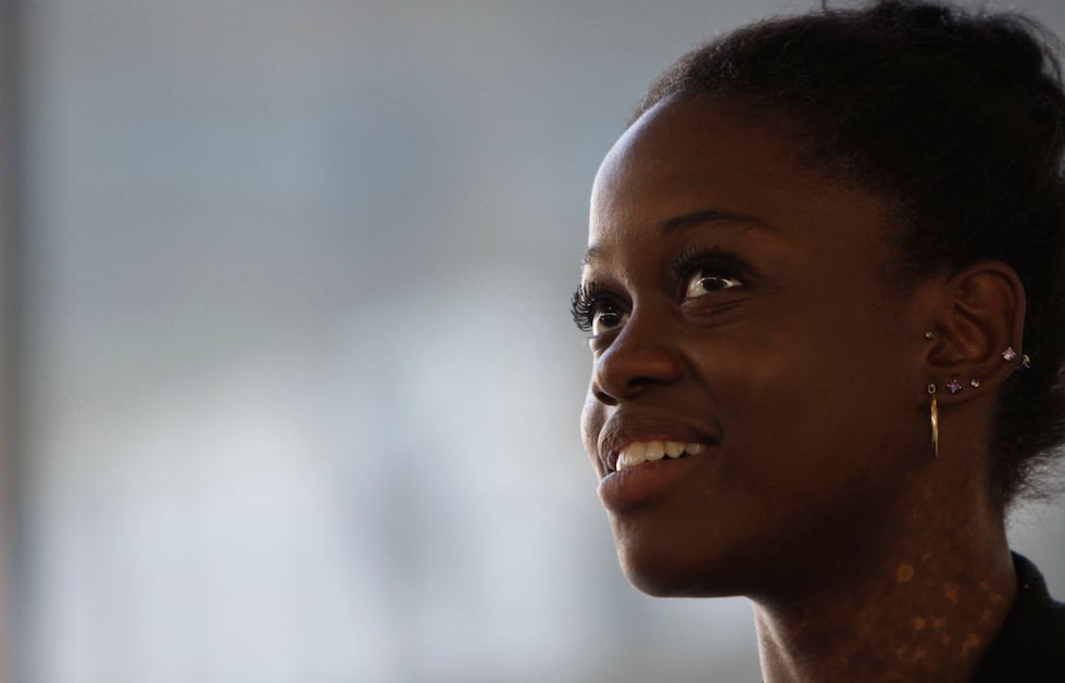 FILE - This Monday July 9, 2012 photo shows dancer Michaela DePrince in Johannesburg. (AP...